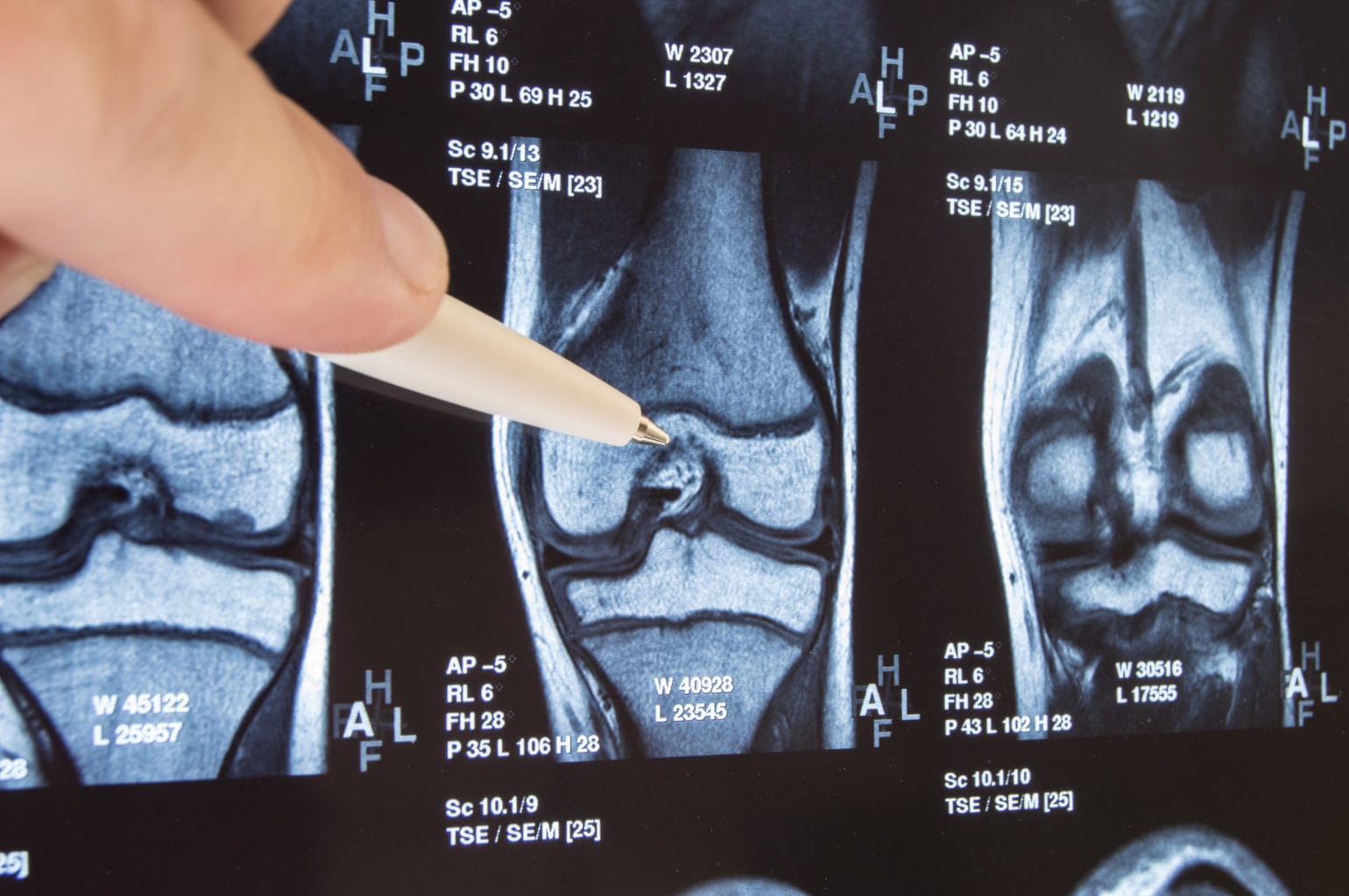 Treatment Timelines: When Your Healthcare Requires More Than a Single Doctor’s Visit